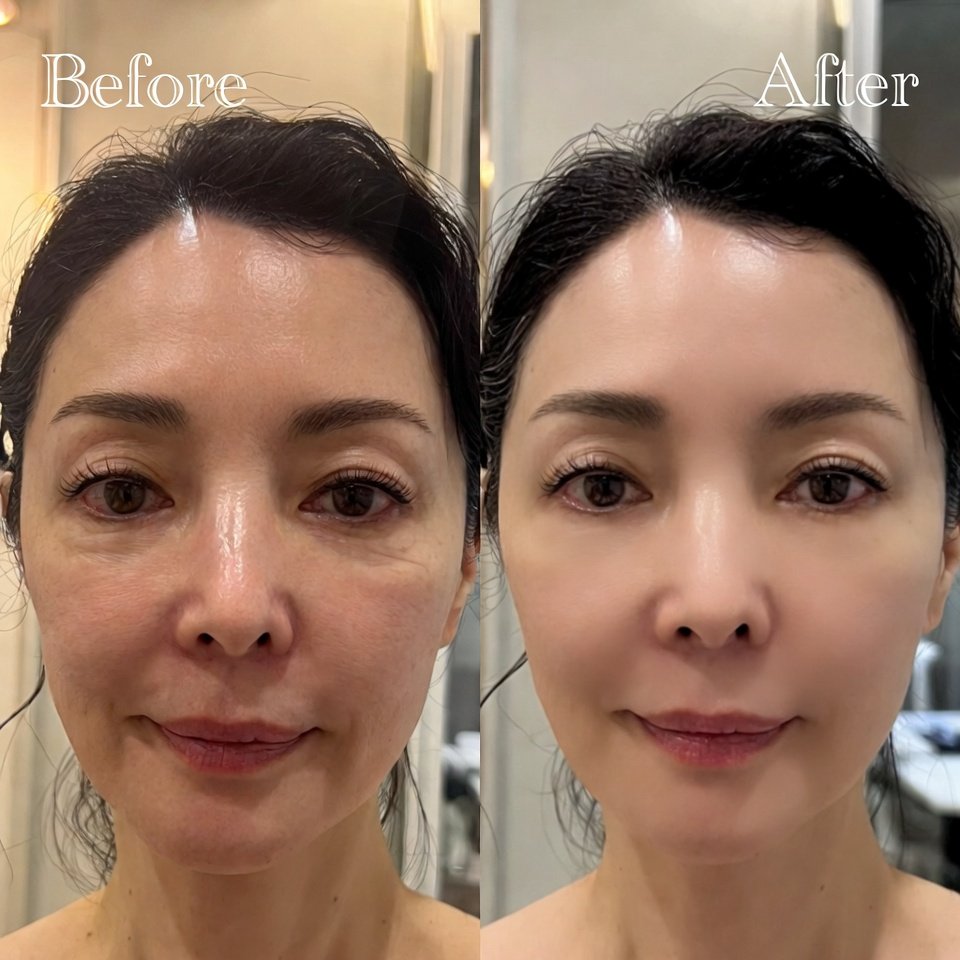 Antes e depois - Renata