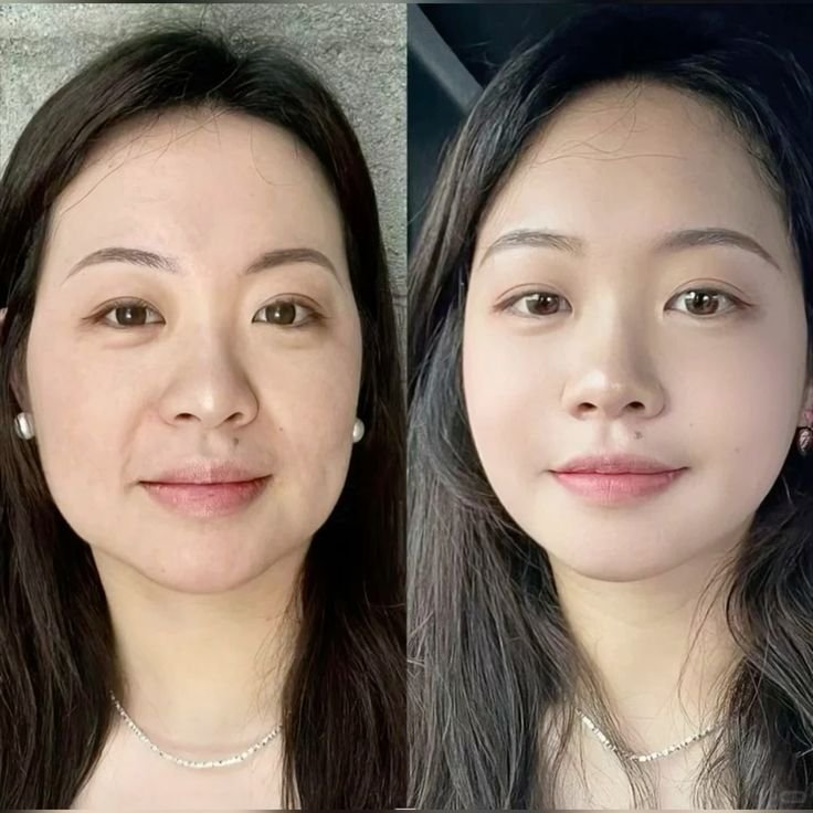 Antes e depois - Julia